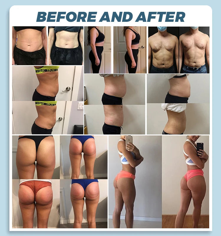 15 Tesla 6500W EMS Body Sculpting Machine  NEO New System Body Slimming Sculpting Fat Burning Nova Weight Lose Machine